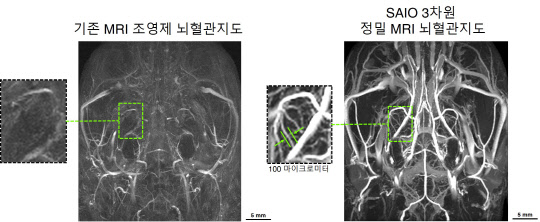 천진우 IBS 나노의학 연구단장 연구팀이 개발한 '고성능 MRI 조영제'를 이용해 몸 속 미세혈관을 보다 정확하게 볼 수 있는 3차원 정밀 뇌혈관 지도를 완성했다.  IBS 제공